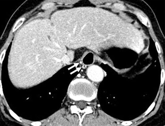 تصویربرداری (سی تی اسکن و ام آر آی)