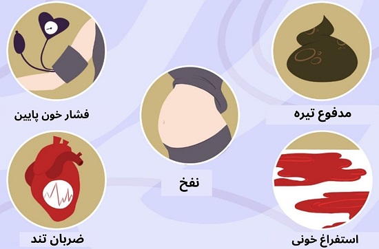 علائم واریس مری