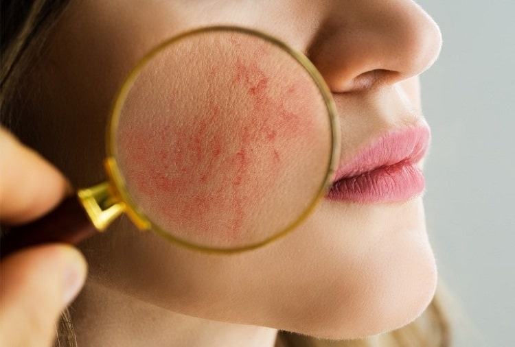 چه زمانی باید به پزشک مراجعه کنیم